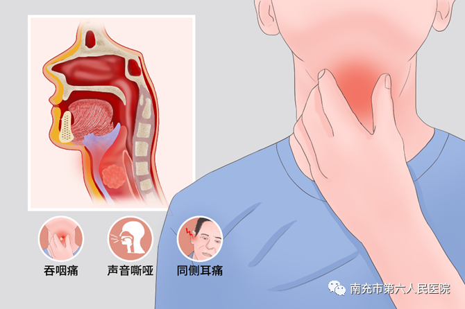 正常脖子吞咽样子图片